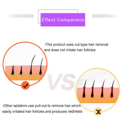 Nextonic™Purple Epilator – آلة إزالة الشعر البنفسجية